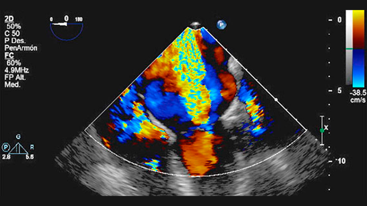 clinica_cardiologia_edo_mex_servicios_5