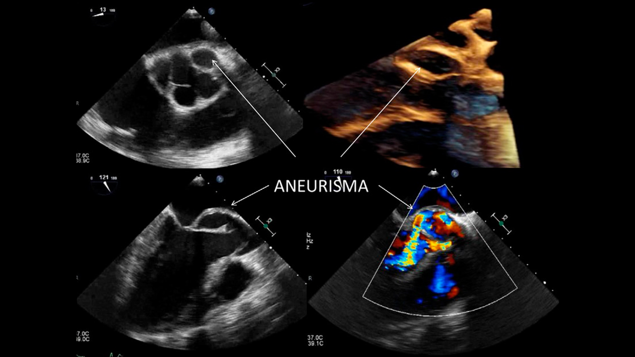 clinica_cardiologia_edo_mex_servicios_4